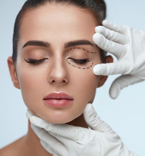 Eyelid Surgery